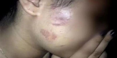 Mulher é espancada, esfaqueada e trancada em casa pelo marido