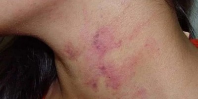 Sogra acusa nora de ter caso com o sobrinho e mulher é surrada pelo marido