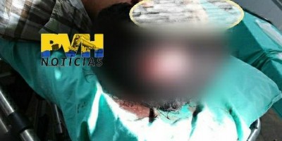 Foragido da justiça se envolve em briga, leva facada na cabeça e acaba preso