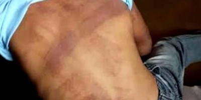 Criança de 12 anos é espancado pela mãe por comer ovo de páscoa em Porto Velho