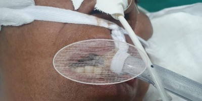 Coren/RO denuncia insalubridade no Hospital de Campanha da Zona Leste em Porto Velho;...