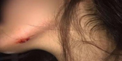 Marido tem crise de ciúmes e surra mulher com socos, chutes e puxões de cabelo