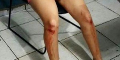 Após ser esfaqueado, marido arrasta mulher com carro e os dois acabam presos