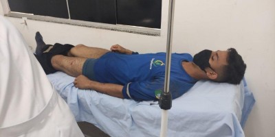 Gari é atacado por cães da raça pitbull em Rolim de Moura