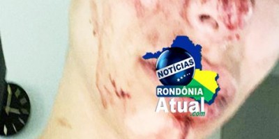 Mulher é espancada durante roubo em Ji-Paraná