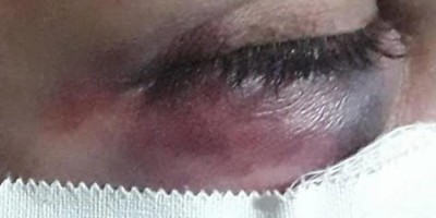 Dona de casa é espancada pelo marido após ele chegar em casa sob efeito de álcool
