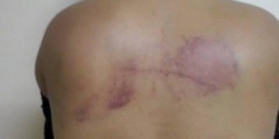 Homem fica com ciúmes de cantor e acaba agredindo namorada que assistia live