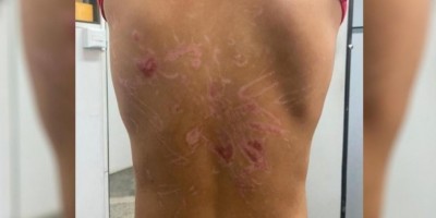 Pai é preso suspeito de torturar o filho de 8 anos com choques elétricos, sessões de...