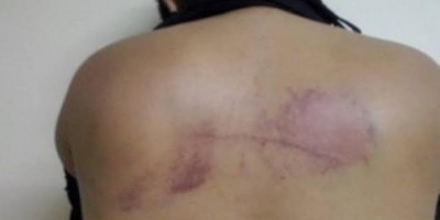 Jovem cobra dinheiro emprestado para a sogra e acaba surrada pelo marido