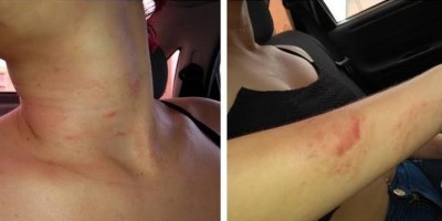 Garota recusa fazer programas sexuais com amigos do irmão e acaba agredida