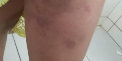 Mulher é atacada a pauladas ao recusar sexo com marido que ficou dois dias na rua
