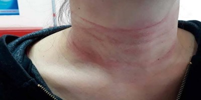 Filho é preso após chegar em casa e tentar matar a mãe enforcada