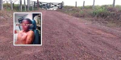 Jovem é espancado por três homens na linha 182 em Rolim de Moura