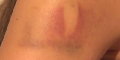 Mulher é agredida com pauladas e socos ao pedir para vizinhos baixarem o som 
