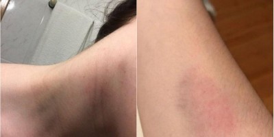Mulher embriagada ataca irmã com socos, mordidas e destrói moto a tijolada após...