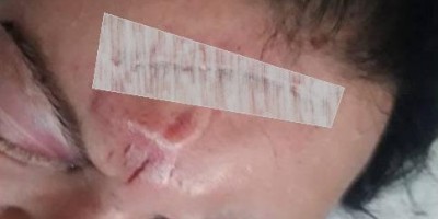 Vilhena: Mulher é espancada violentamente pelo marido e salva pelo vizinho que ouviu os...