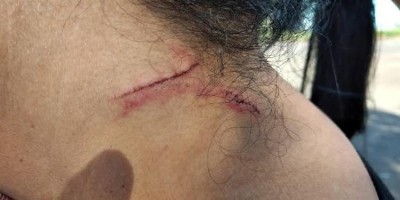 Mulher é estuprada e agredida pelo ex-marido em residência
