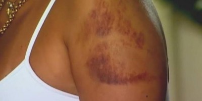 Mulher e enteada de 12 anos acabam espancadas por homem após ele ser questionado sobre...