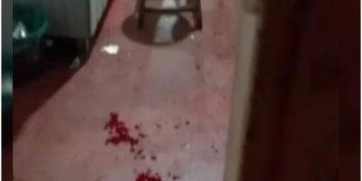 Homem é baleado durante briga de bar em Rondônia