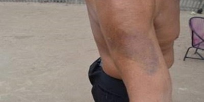Marido chega em casa tarde e é agredido com pauladas e cadeiradas pela esposa