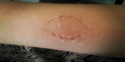 Jovem tenta defender a cunhada e é surrada pelo irmão com socos e mordidas