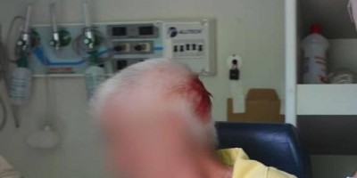 Adolescente de 16 anos com transtornos psiquiátricos tenta matar o próprio pai, de 62,...
