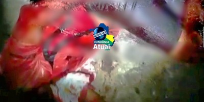 Homem sofre tentativa de homicídio a golpes de facão em Ji-Paraná
