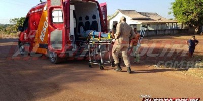 Homem fratura a perna após se desequilibrar e cair da garupa de moto táxi em Rolim de...