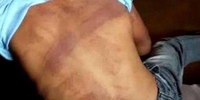 Pai denuncia e mãe é presa acusada de espancar o filho