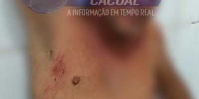 Cacoal: Homem chega embriagado em casa e leva surra da sogra e da mulher