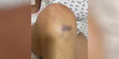 Namorado agride e estupra mulher em residência em Porto Velho