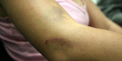 Mãe é espancada pelas filhas por beber com amiga em residência