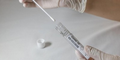 Covid-19: Os sete casos da variante delta foram identificados em seis municípios,...