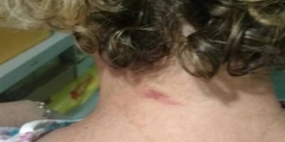 Mulher é agredida pelo marido ao ser acusada de dar droga ao filho
