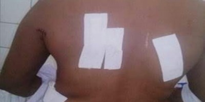 Dona de casa é atacada a golpes de faca ao cobrar pensão de ex-marido