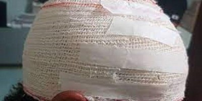 Marido encontra mulher com outro dentro de casa e ainda leva surra do suposto amante
