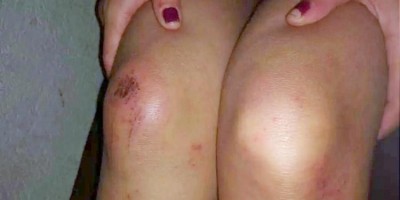 Dona de casa é agredida pelo marido após pedir pra ele comprar comida para os filhos