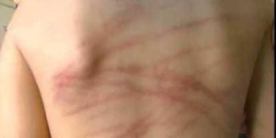 Pai é preso após agredir filho de oito anos com galho de mangueira