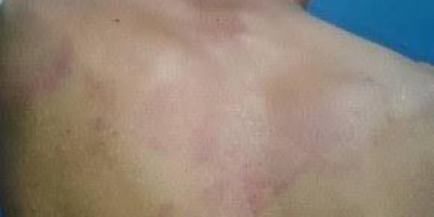 Padrasto é agredido a pauladas pelo enteado durante bebedeira entre familiares