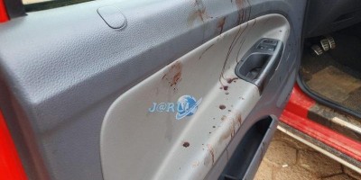 Homem é baleado no pescoço e mão após ser perseguido por assassino em Jaru