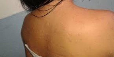 Mulher de resguardo é agredida na barriga por marido que passou a madrugada na rua