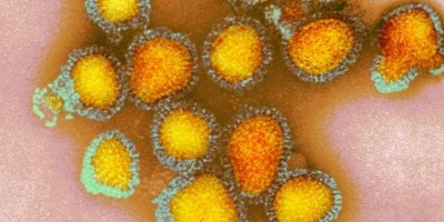 Sesau confirma quatro novas mortes por Influenza em Rondônia; Total já chega a 8 apenas...