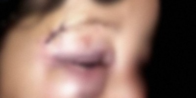 Grávida de sete meses perde o bebê após ser espancada pelo ex-marido