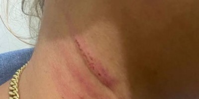 Mulher acaba surrada por tentar intervir em briga de casal