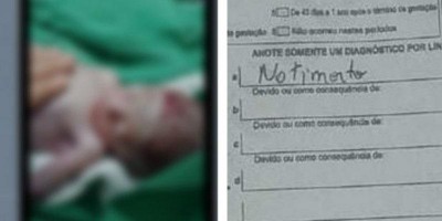 Ariquemes: Bebê levado vivo para funerária morre após 15 dias internado em UTI