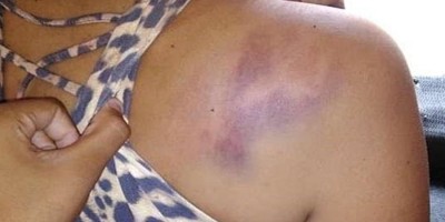 Mulher é espancada pelo marido após beber na casa dos primos