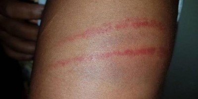 Mulher é agredida e torturada ao aceitar carona do ex-marido