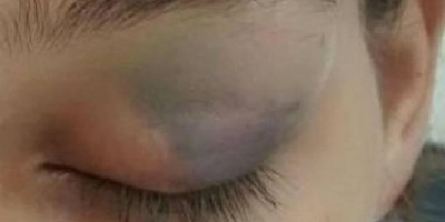 Mulher é agredida pelo marido, mas não deseja vê-lo preso e se recusa a fazer denúncia