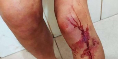 Vilhena: Mulher é sequestrada, torturada e ameaçada para retirar queixa contra...