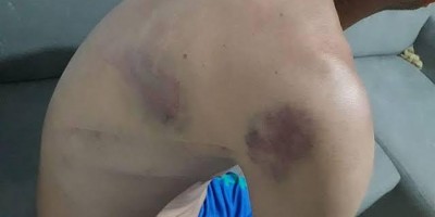 Jovem apanha da ex-mulher por atrasar pensão alimentícia da filha